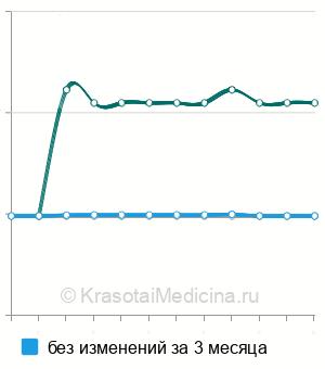 Средняя стоимость рентген ВНЧС в Екатеринбурге