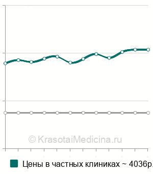 Средняя стоимость КТ костей таза в Екатеринбурге