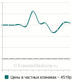 Средняя стоимость МРТ кисти в Екатеринбурге