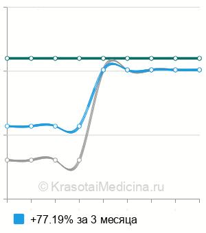 Средняя стоимость рентген трахеи в Екатеринбурге