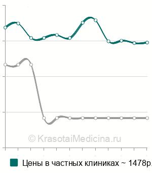 Средняя стоимость анализ крови на PAPP-A (ассоциированный с беременностью белок А) в Екатеринбурге