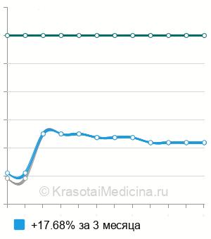 Средняя стоимость рентген сердца с контрастированием пищевода в Екатеринбурге