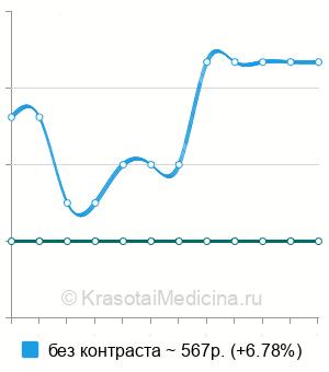 Средняя стоимость рентген пищевода в Екатеринбурге