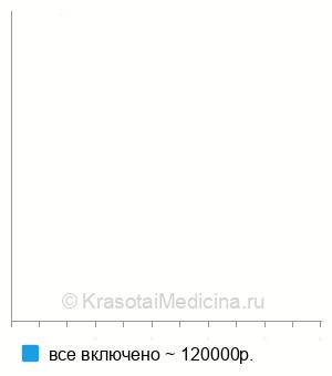 Средняя стоимость однополюсное эндопротезирование тазобедренного сустава в Екатеринбурге