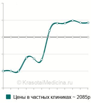 Средняя стоимость электронейромиография (ЭНМГ) в Екатеринбурге