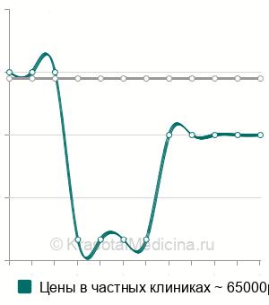 Средняя стоимость иссечение ретроцервикального эндометриоза в Екатеринбурге