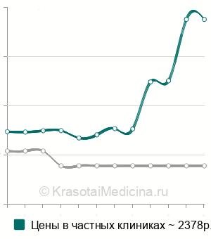 Средняя стоимость посев на флору с антибиотикограммой у женщин в Екатеринбурге