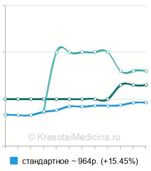 Средняя стоимость УЗИ лимфатических узлов в Екатеринбурге