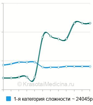 Средняя стоимость липосакция подбородка в Екатеринбурге