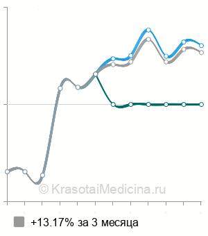 Средняя стоимость МРТ сосудов головного мозга в Екатеринбурге