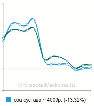 Средняя стоимость МРТ тазобедренного сустава в Екатеринбурге