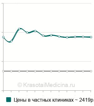 Средняя стоимость блокада триггерных точек в Екатеринбурге