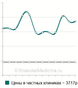 Средняя стоимость блокада карпального канала в Екатеринбурге