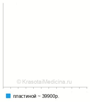 Средняя стоимость остеосинтез диафизарных переломов бедра в Екатеринбурге