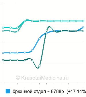 Средняя стоимость КТ аорты в Екатеринбурге