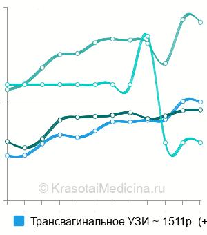 Средняя стоимость УЗИ органов малого таза у женщин в Екатеринбурге