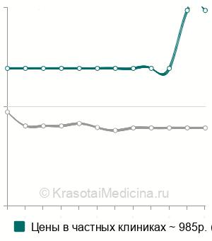 Средняя стоимость эхоэнцефалографии (ЭХО-ЭГ) в Екатеринбурге