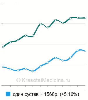 Средняя стоимость УЗИ локтевых суставов в Екатеринбурге