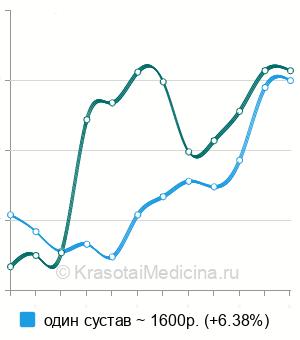 Средняя стоимость УЗИ плечевых суставов в Екатеринбурге