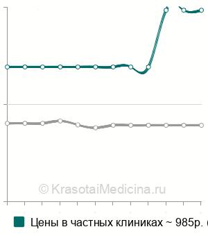 Средняя стоимость эхоэнцефалография (ЭХО-ЭГ) в Екатеринбурге